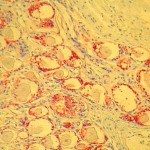 Immunohistochemical (IHC) technique for glial fibrillary acidic protein (GFAP)